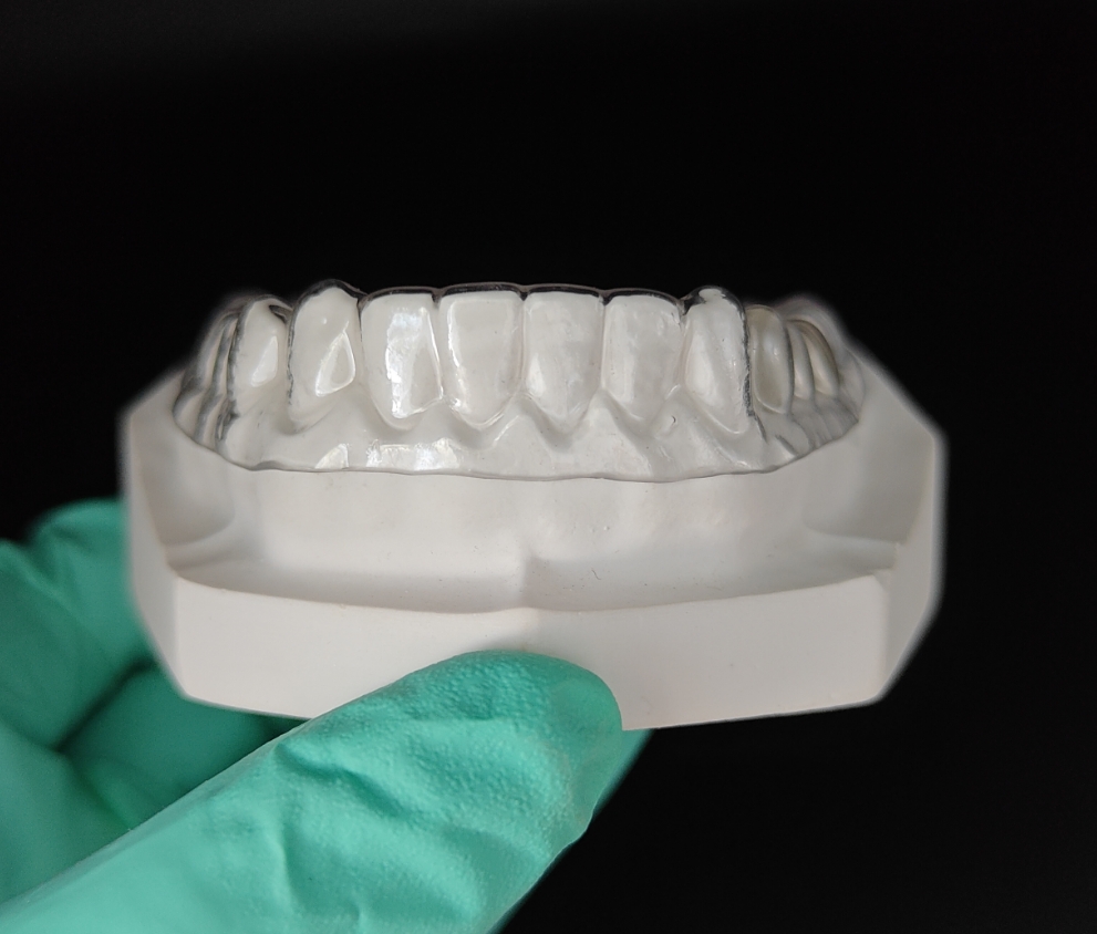 Learn about ESSIX® retainers: types, benefits, and care