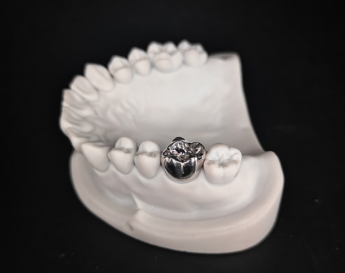 dental cast crown