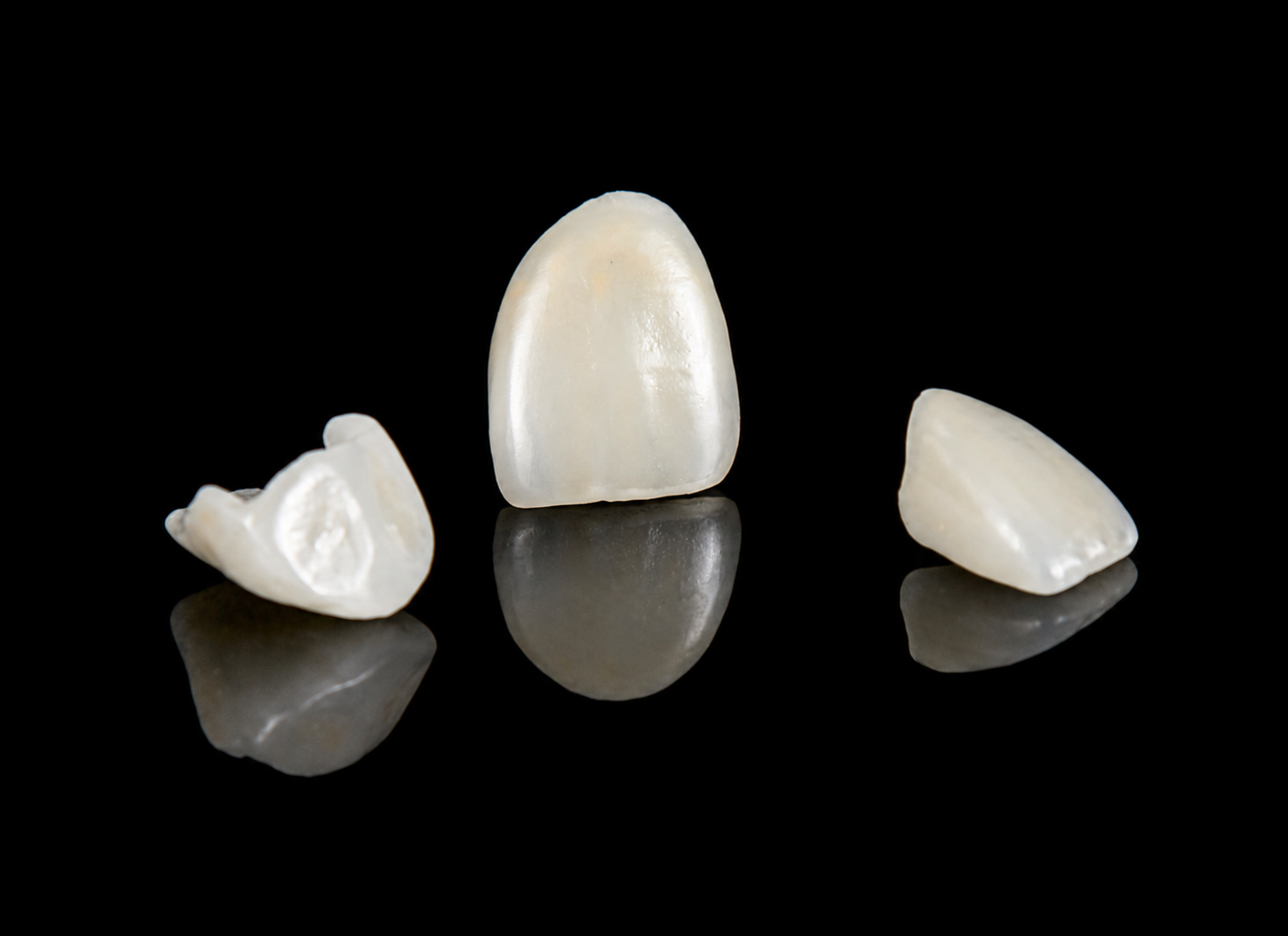 E.max full ceramic crown