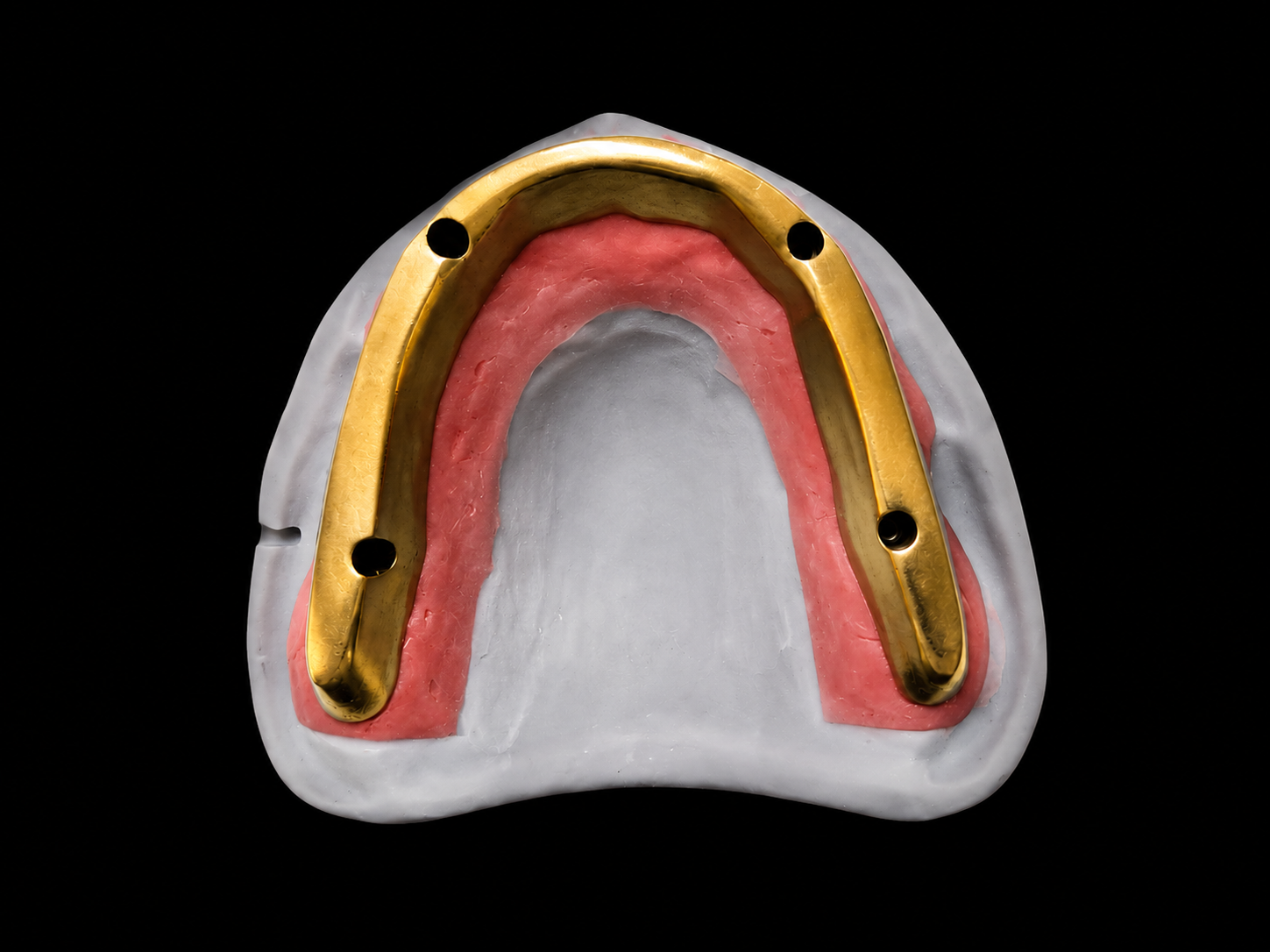 Cast custom implant framework