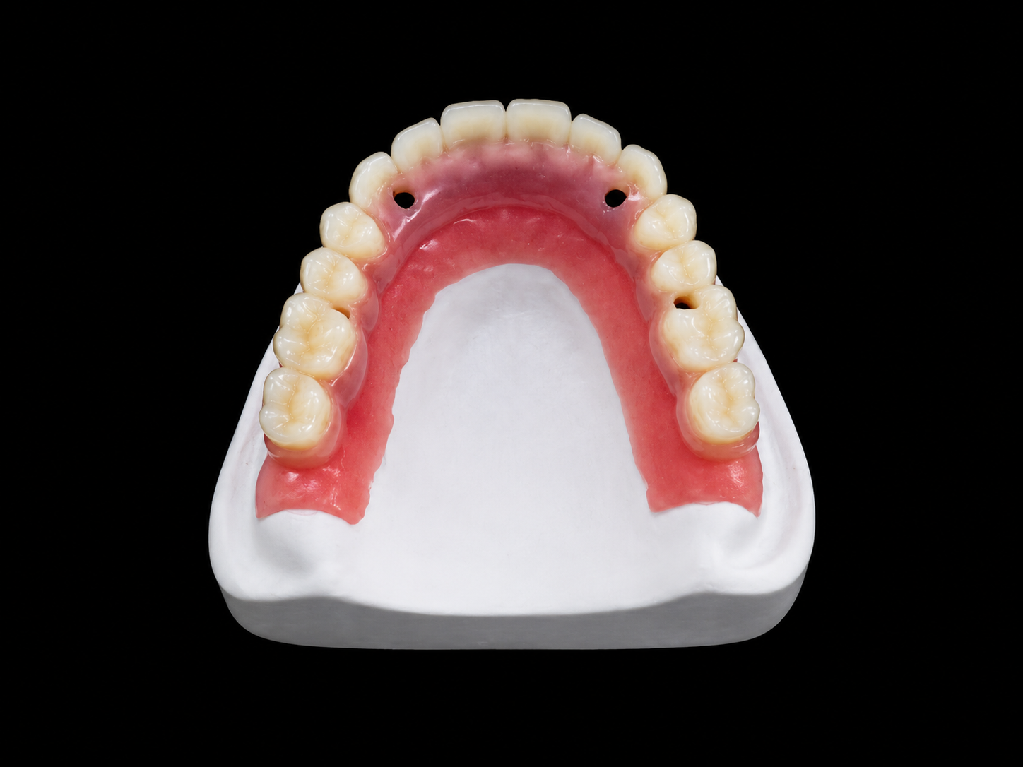 Implant Overdenture.png