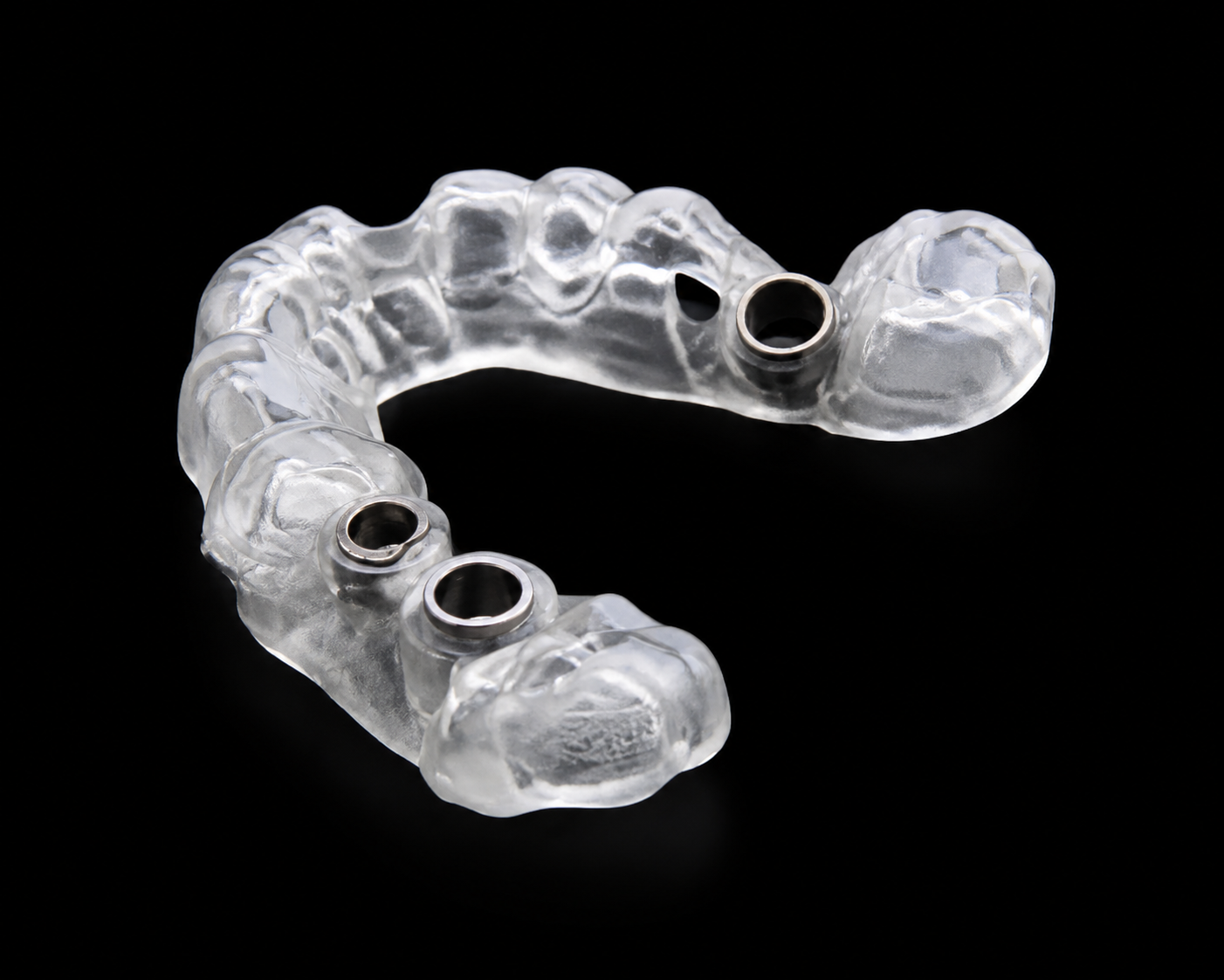 Custom implant surgical guide