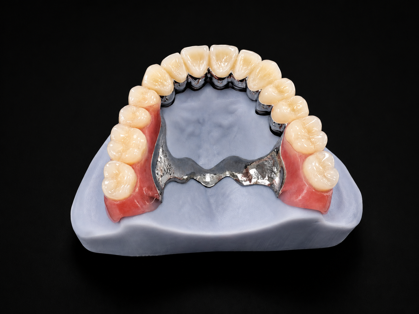 Telescopic Denture.png