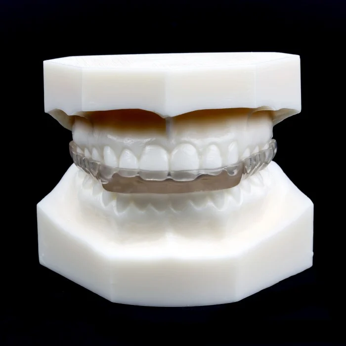 Occlusal Splints