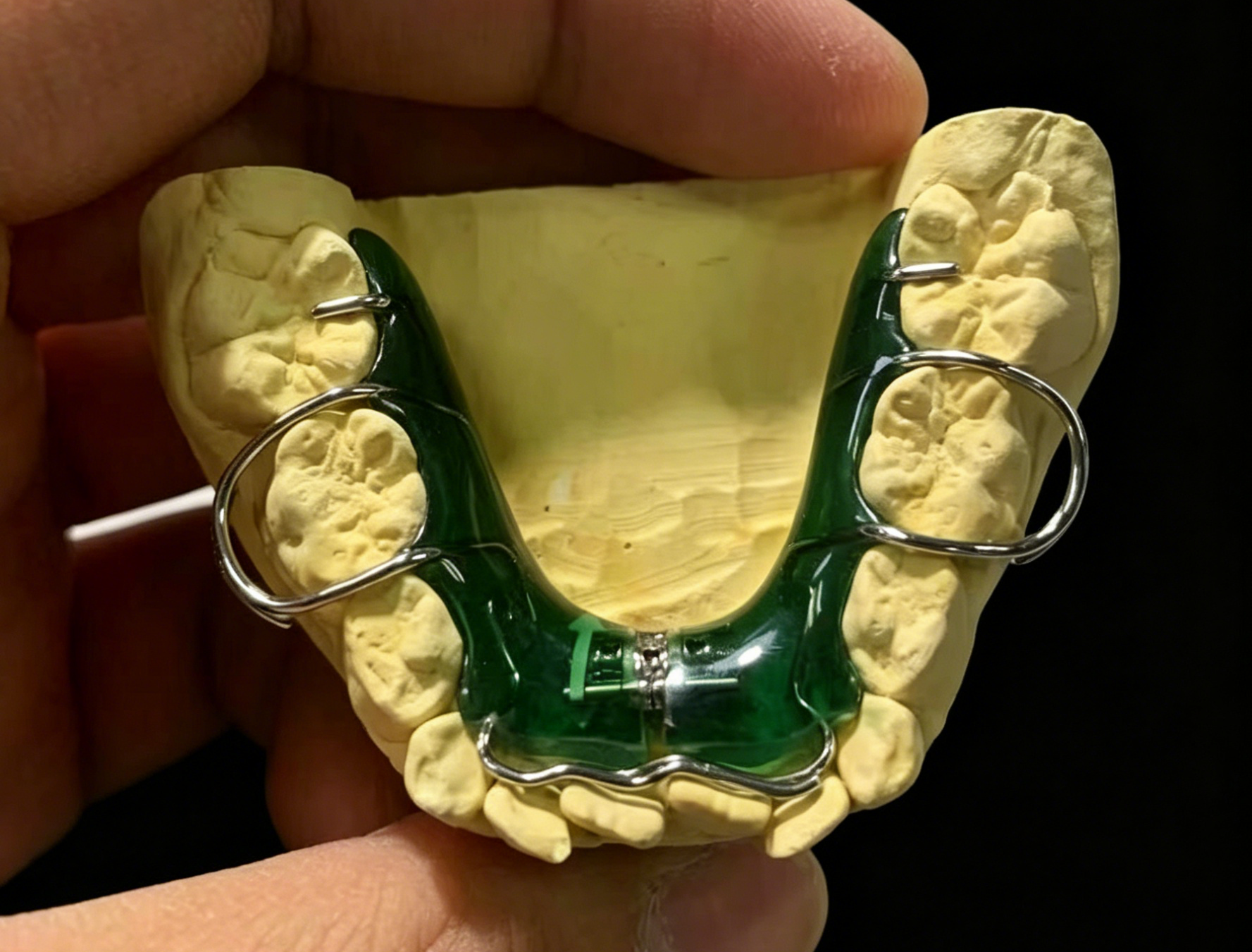 Custom screw expander