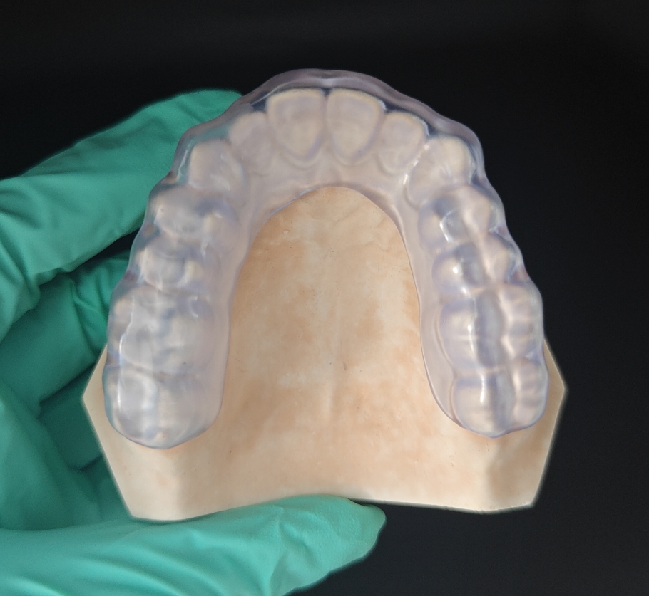 KeySplint occlusal splint