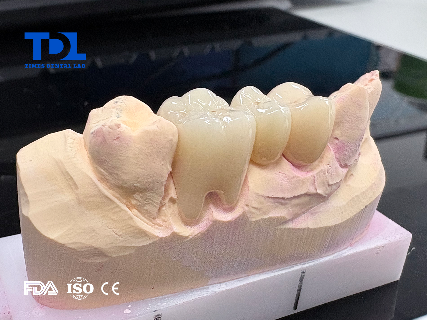 How Dental Labs Prevent Zirconia Crown Fractures