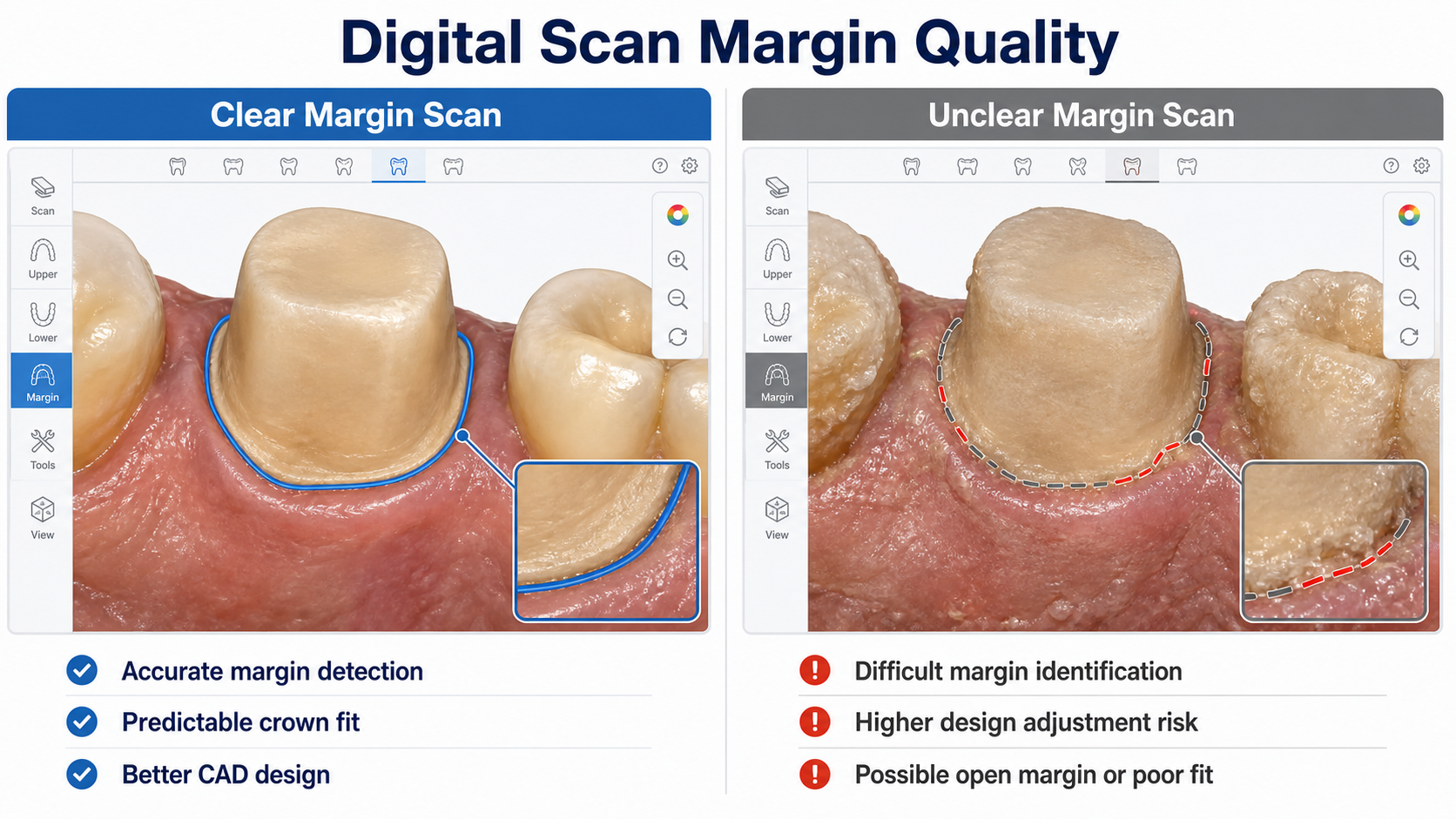 clear-vs-unclear-digital-scan-margin.png