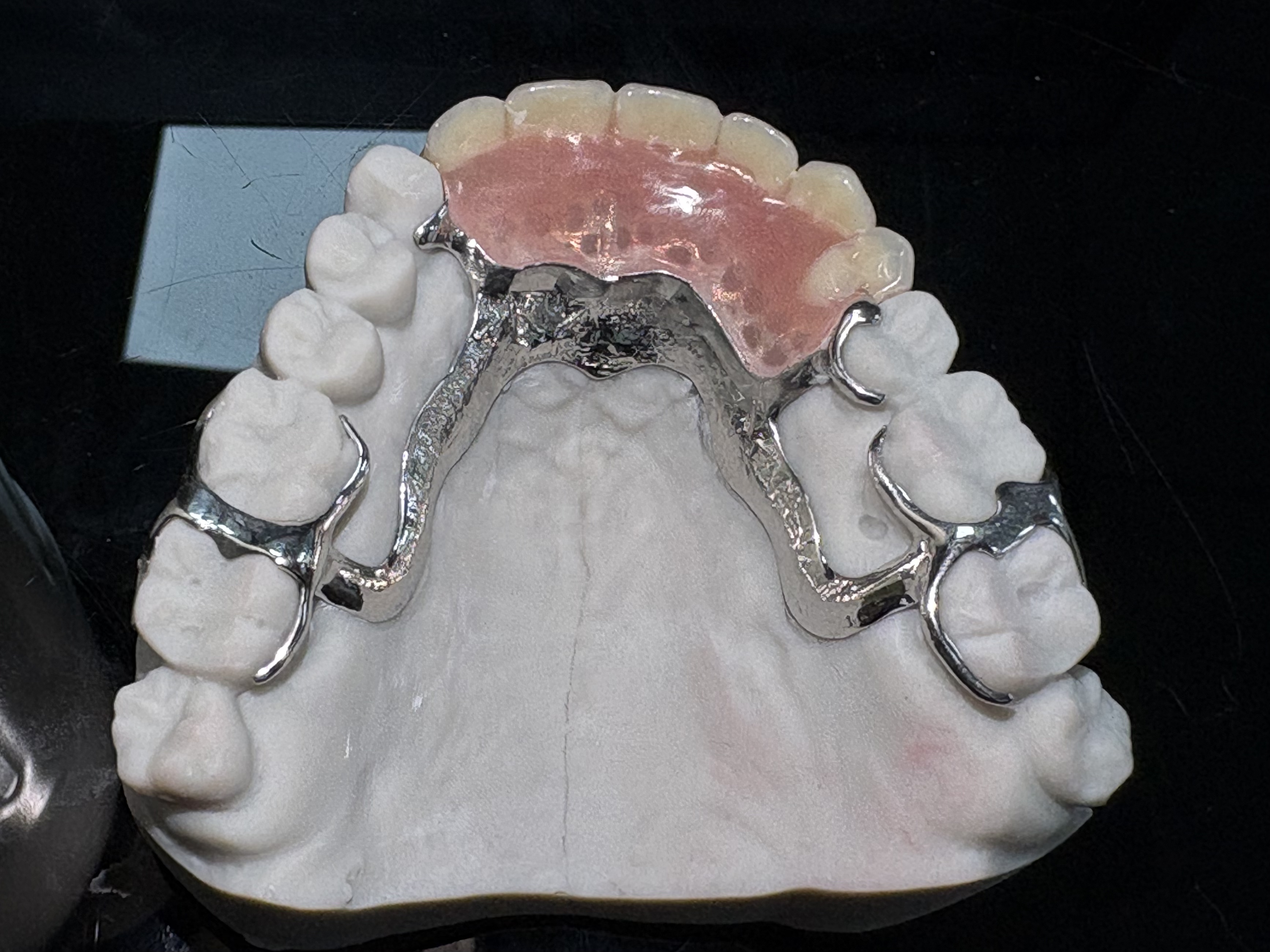 prothèses dentaires acryliques2.jpg