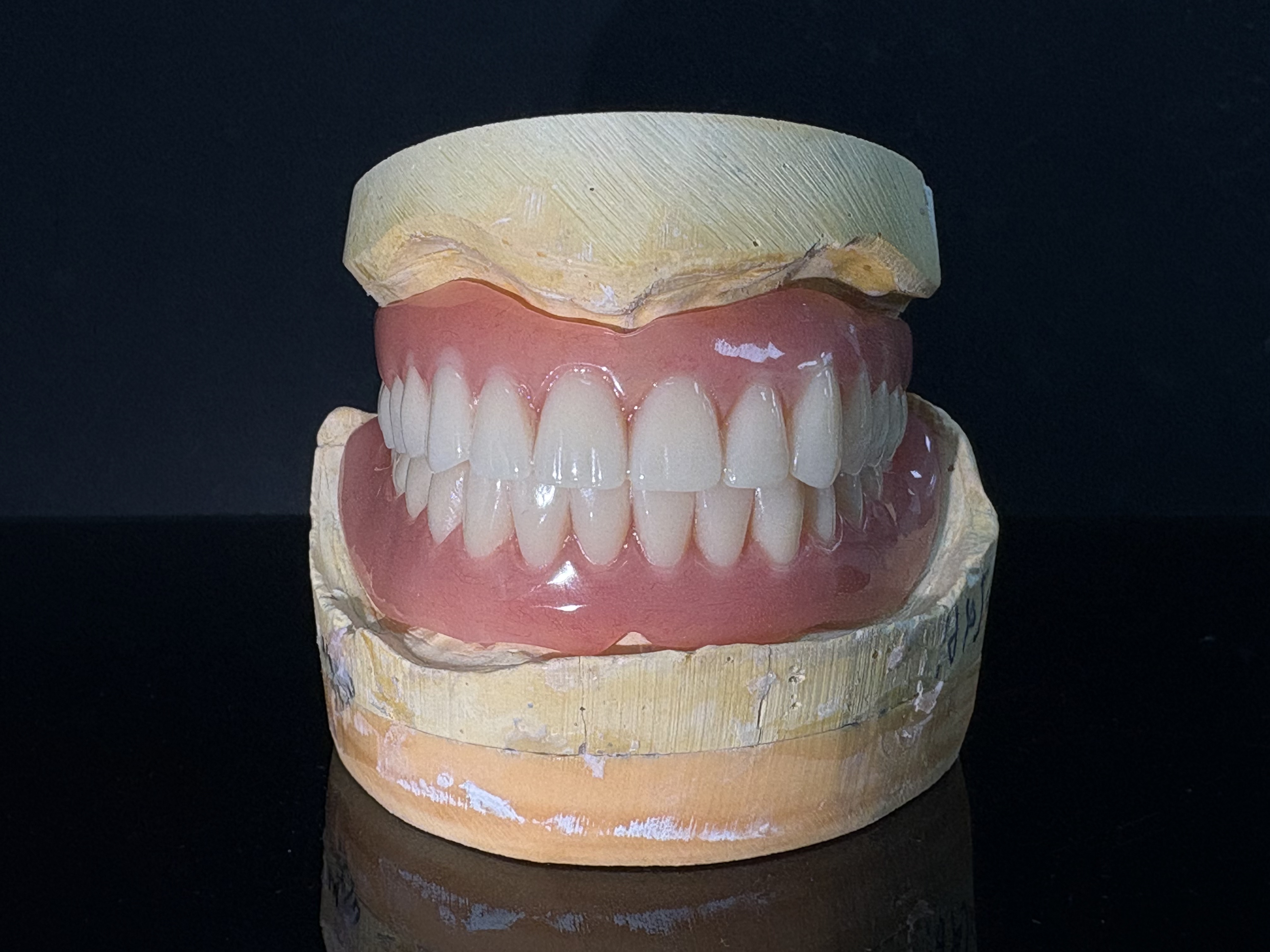 Prothèses dentaires en acrylique et Valplast du laboratoire Times Dental : des solutions amovibles pour les cliniques et laboratoires à l’étranger