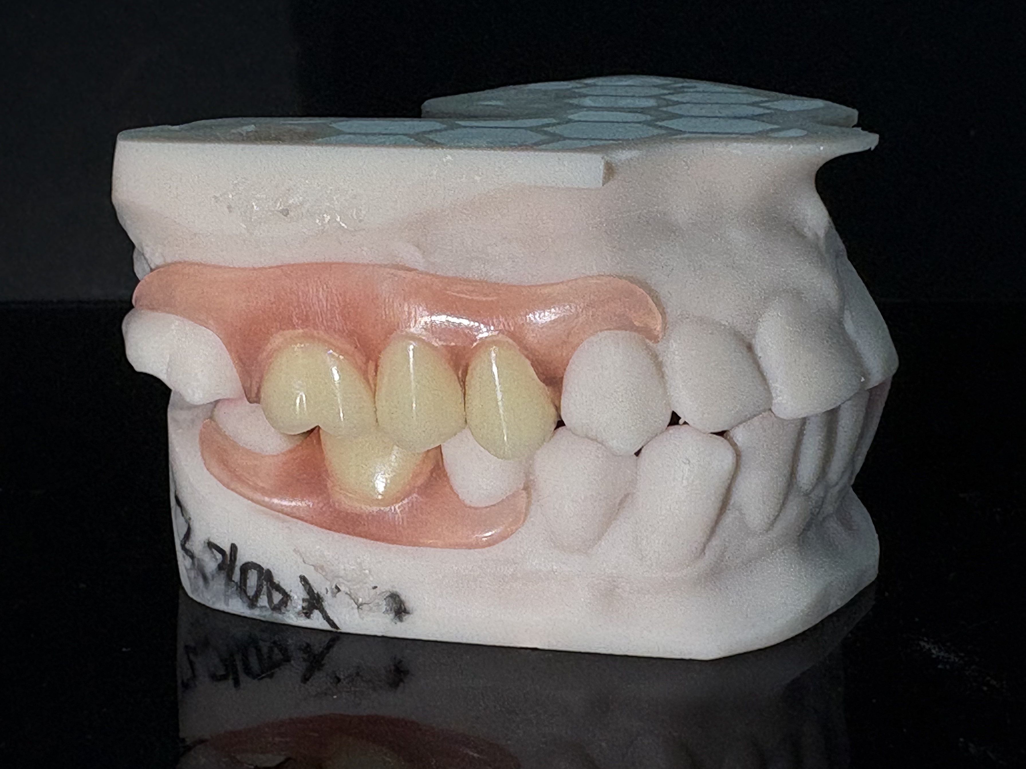 How to Choose a Removable Denture Lab: A Practical Guide for Dental Professionals