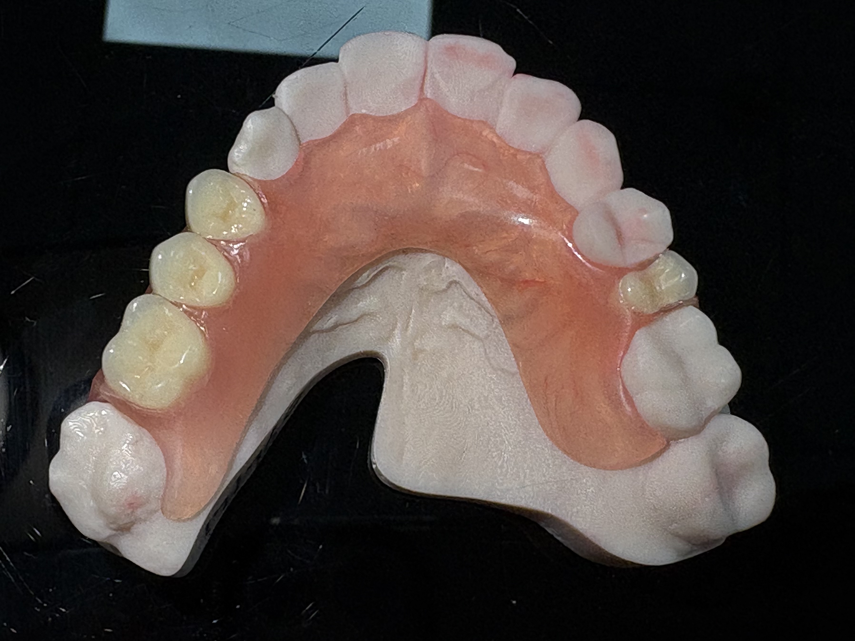 prothèses dentaires Valplast7.jpg